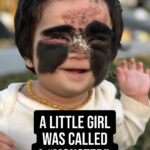 ST, A Little Girl Was Bullied and Called a “Monster” Because of Her Birthmark, Now She Found Her Inner Princess