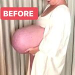 ST, Mom’s Baby Bump Was So Huge People Thought She Was Carrying 8 Babies